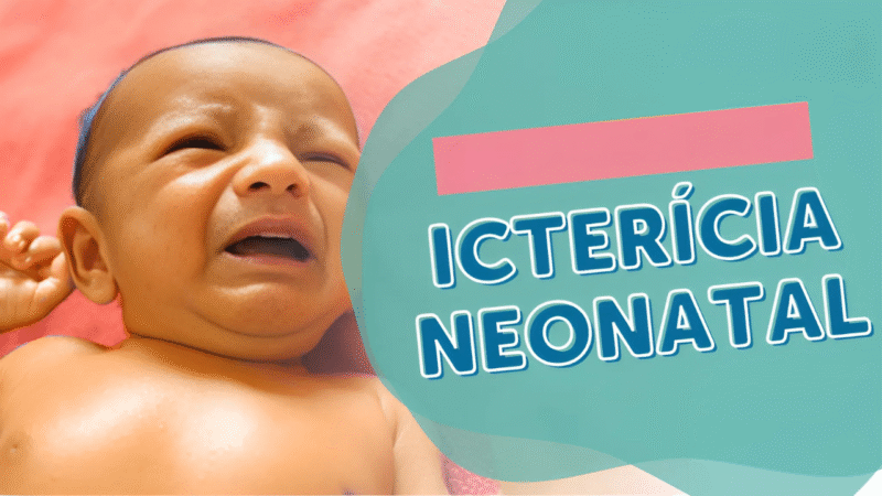 Icterícia neonatal: o que é, causas e tratamentos disponíveis